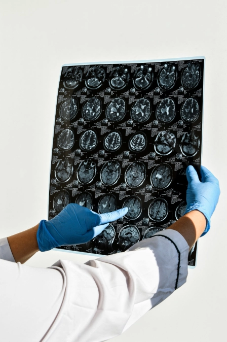 невролог ведет прием на дому